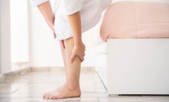 Varices ¿Cómo prevenir su aparición?